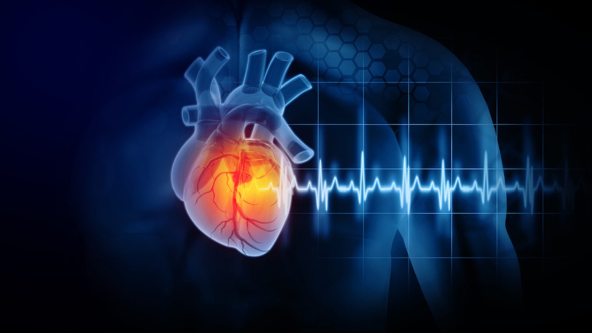 Heart attack illustration