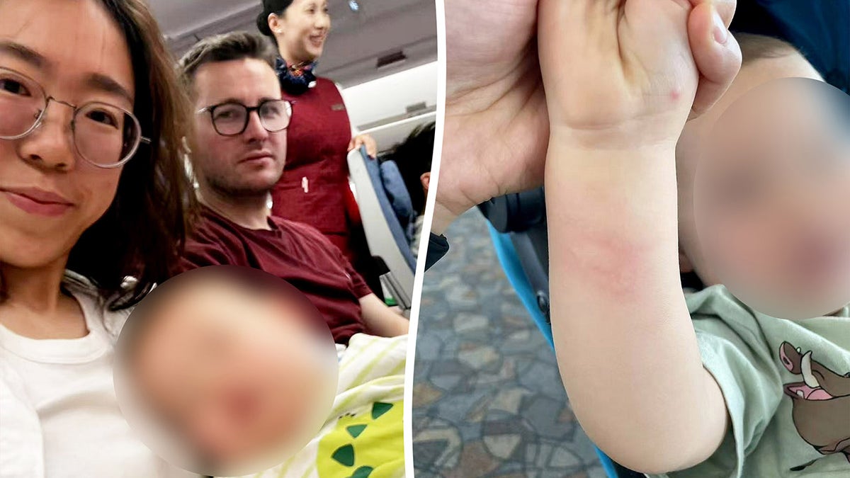 The image divided, one side shows that the man and the woman sat on the flight with a flight assistant in the background. Mom holds her baby on her lap (baby's face blur) as she and her husband look at the camera. The other side shows one of the parents who holds their baby's right arm to show errors on the forearm and hand. Baby's face is also blurred