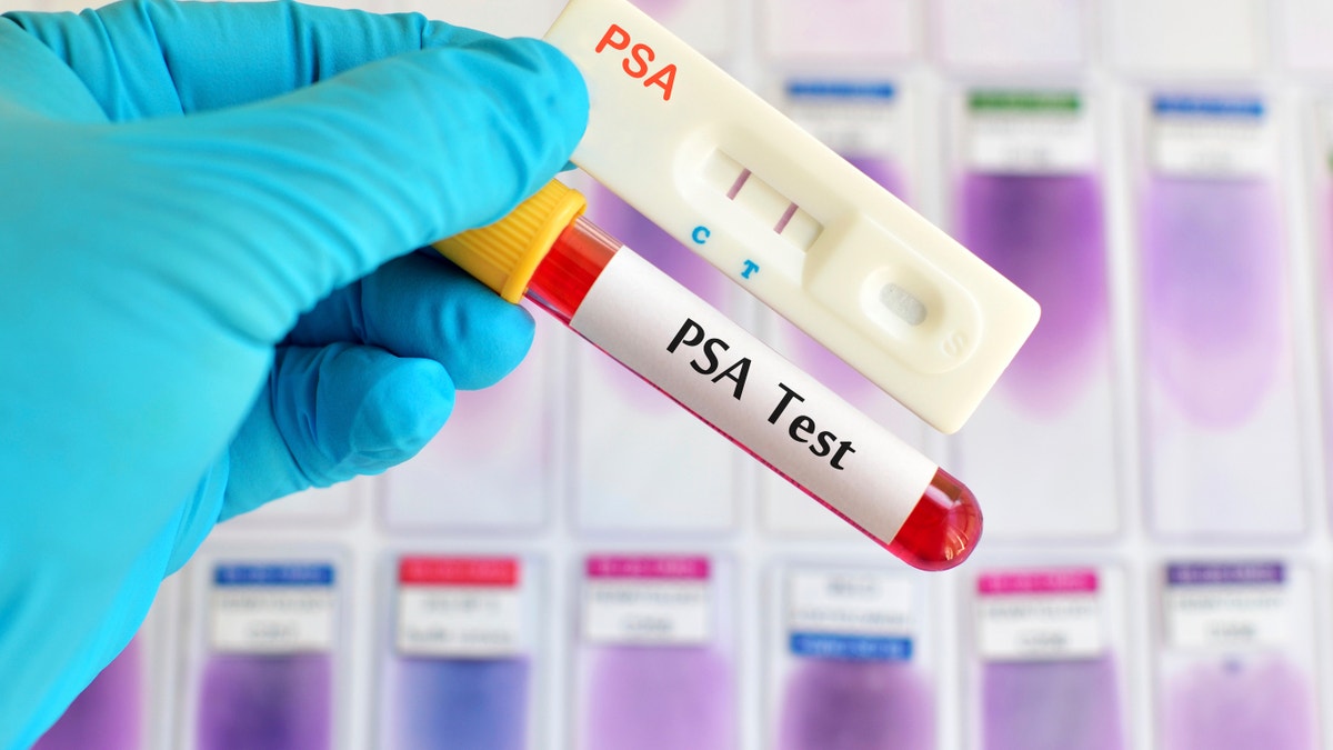 PSA tests (Prostate Cancer Diagnosis) using test casset